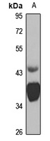 Anti-MR1 Antibody