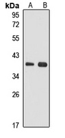 MRPS31 antibody
