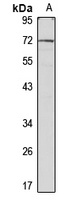 Anti-Mesothelin Antibody