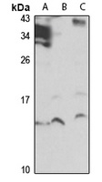 Anti-MSRB1 Antibody