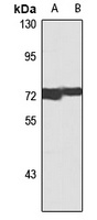 Anti-MTA2 Antibody