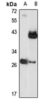 Anti-COX3 Antibody