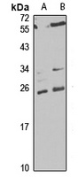 MTP18 antibody