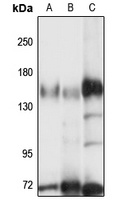 Anti-MTMR4 Antibody