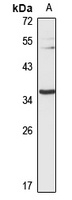 Anti-MT-ND1 Antibody
