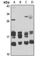 Anti-MT-ND3 Antibody