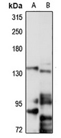 Anti-MTR Antibody