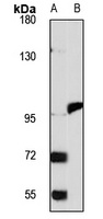 Anti-MTTP Antibody