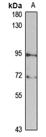 Anti-MUSK Antibody