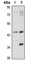 Anti-MVD Antibody