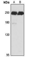 Anti-Myoferlin Antibody