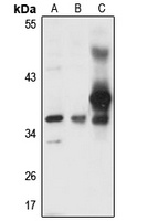 Anti-Myozenin-1 Antibody