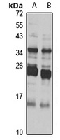 N6AMT2 antibody