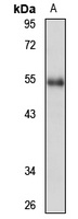 NAB1 antibody