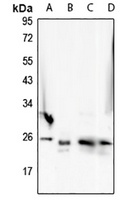 Anti-NANP Antibody