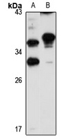 NAT-2 antibody