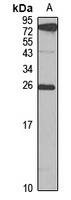 NAT-8B antibody
