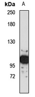 Anti-NAV2 Antibody