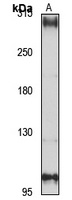 Anti-NBEAL2 Antibody