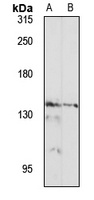Anti-NCOA3 Antibody