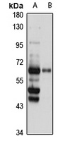 Anti-NCOA5 Antibody