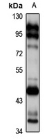 Anti-CD336 Antibody