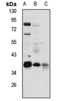 Anti-NDUFAF1 Antibody