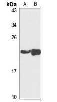 Anti-NDUFAF4 Antibody