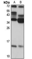 Anti-NDUFB3 Antibody