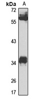 NEK6 antibody