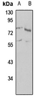 NEK8 antibody