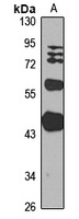 Anti-Neu2 Antibody