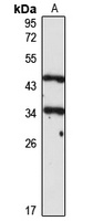 NF-1B antibody