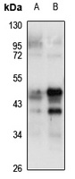 Anti-NFKBIL1 Antibody