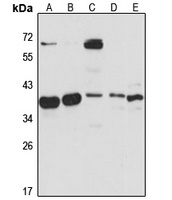 NGDN antibody