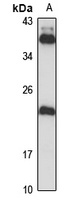 Anti-NHP2 Antibody