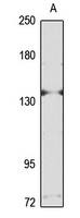 NLRP5 antibody