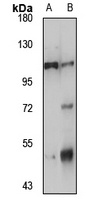 Anti-NLRP6 Antibody