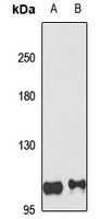 Anti-NLRP7 Antibody