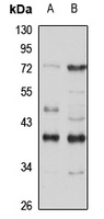 Anti-Nmi Antibody