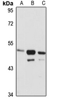 Anti-NMUR2 Antibody