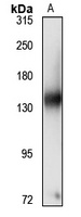 Anti-NOMO2 Antibody