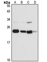 NOP16 antibody