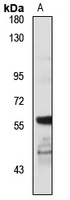 Notum antibody