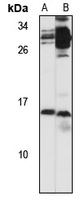 Anti-NPB Antibody