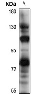 Anti-NPR2 Antibody