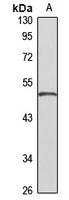 Anti-SDR1 Antibody