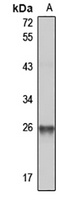 Anti-NQO2 Antibody