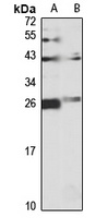 Anti-NQO2 Antibody