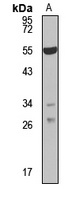 Anti-SXR Antibody